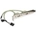 TruConnect 1 x USB-Halterungsbuchse, 2 x 5-polig